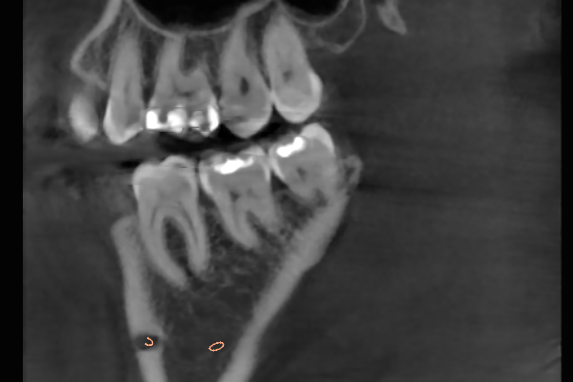 DVT 3D Diagnostik