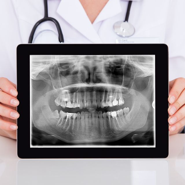DVT 3D Diagnostik